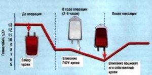 Искусственная кровь
